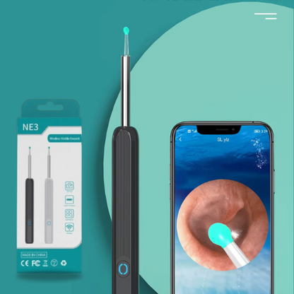 Nettoyeur d'oreille révolutionnaire avec caméra